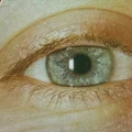 IE  Avatar
