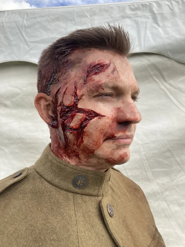 Shining Girls - WW1 Wounds