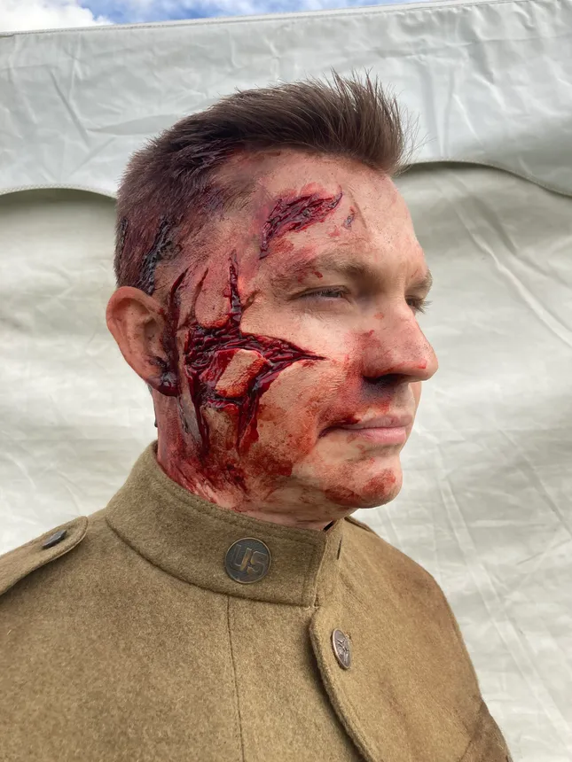 Shining Girls - WW1 Wounds