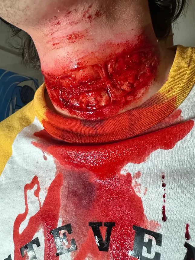 Neck Injury