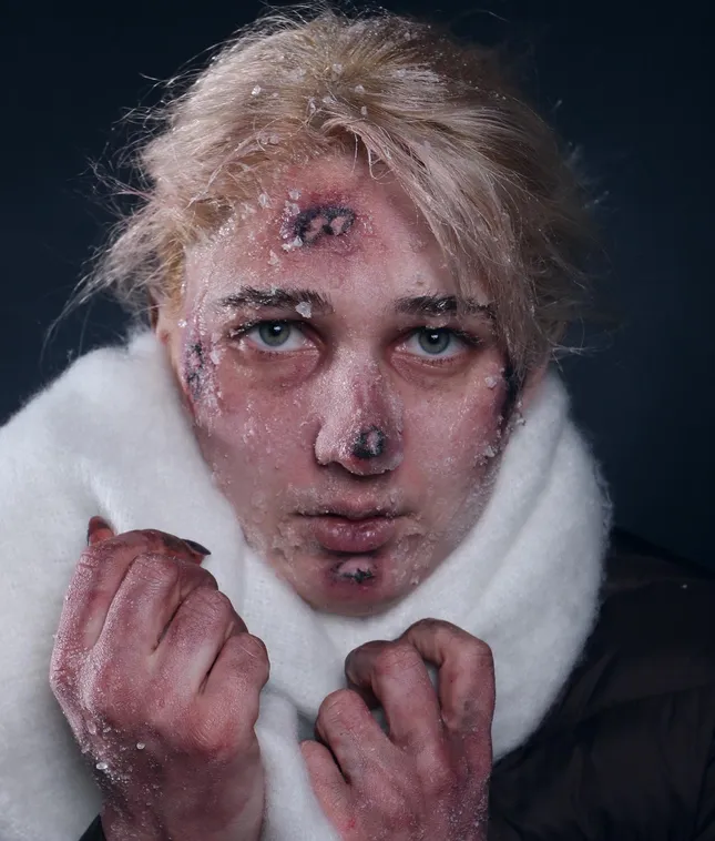 FROSTBITTEN