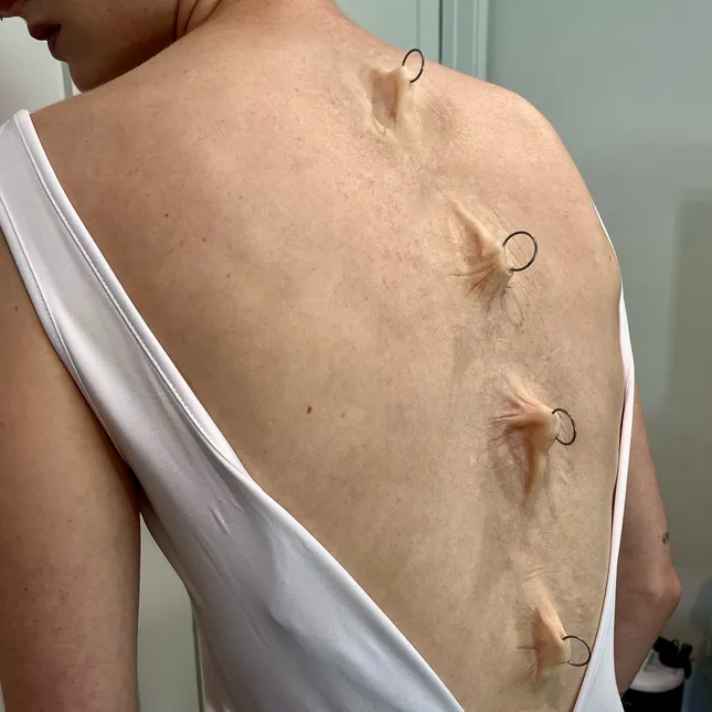 Pulled Skin