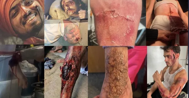Wounds