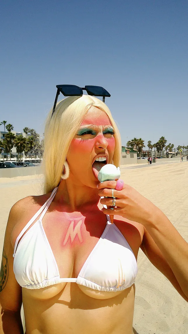 Sunburn