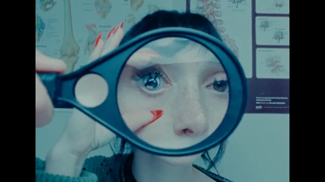Basketcase eye exam