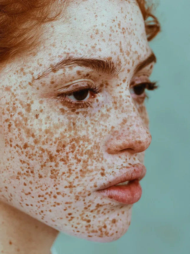 BEAUTY/SKIN