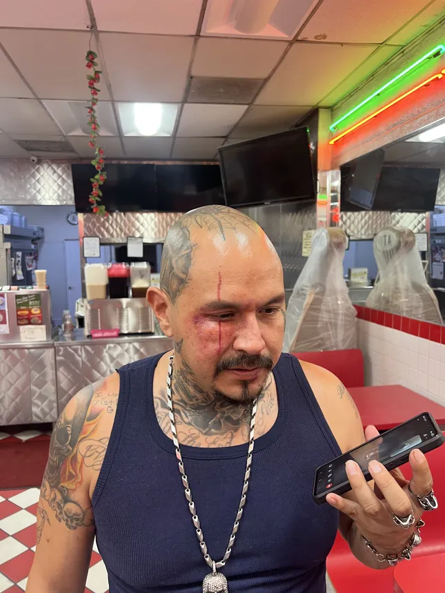Black eye / old age