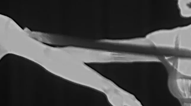 Project image