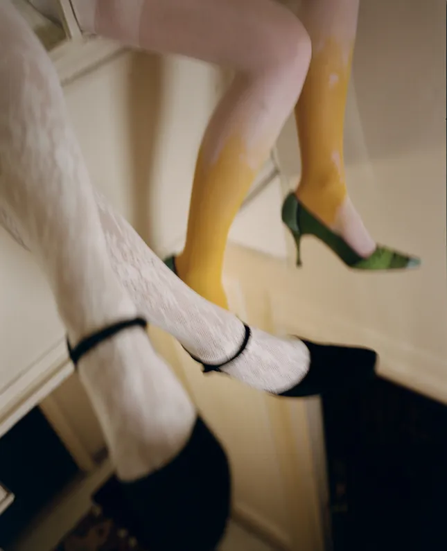 Legs