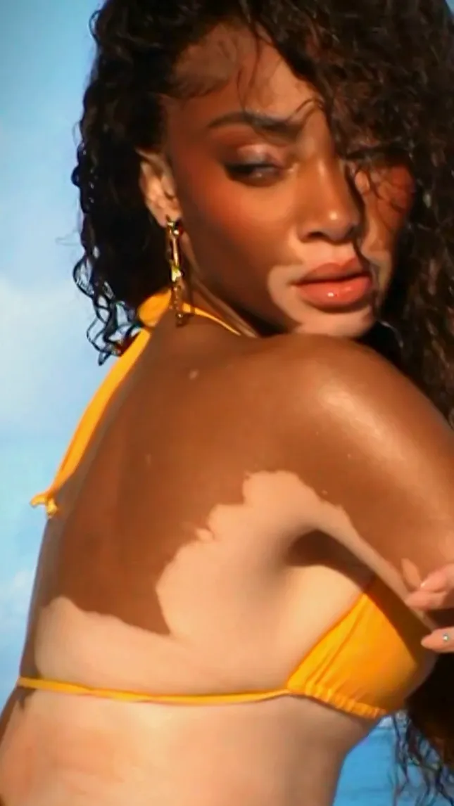 Social Media Manager - Cay Skin by Winnie Harlow