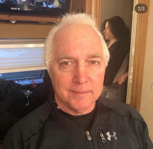 Bald caps & wigs/prosthetics
