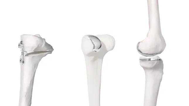 Bodycad -